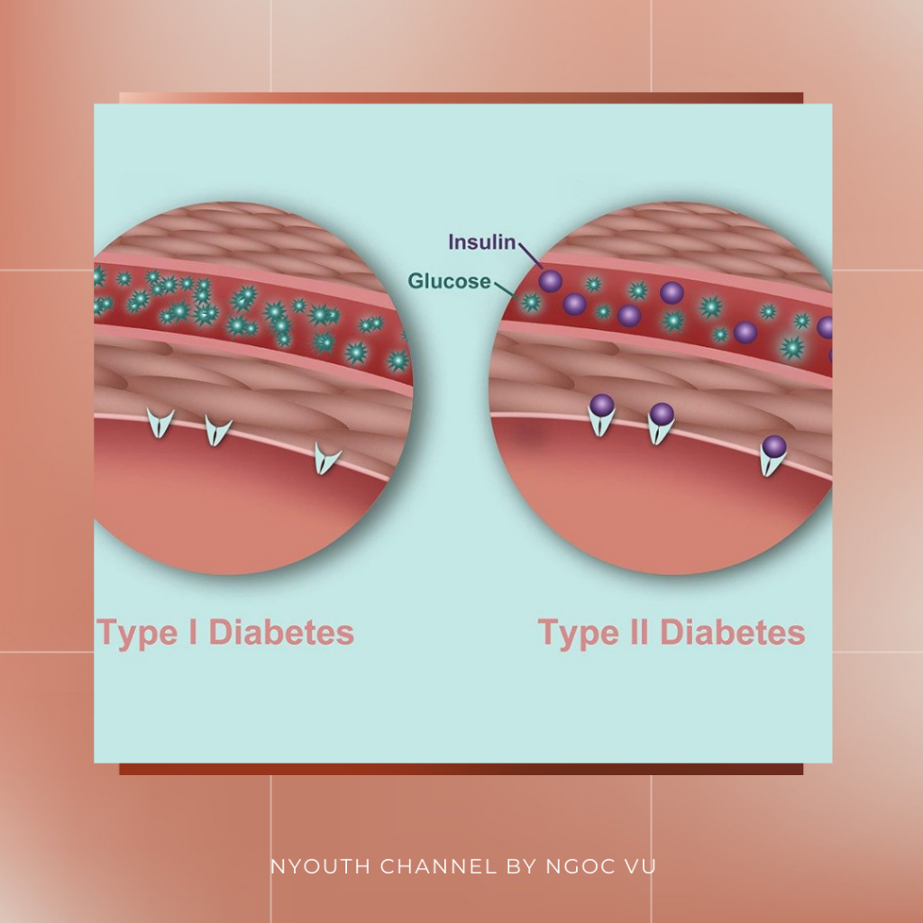 Bệnh tiểu đường & biện pháp cải thiện từ gốc | NYOUTH CHANNEL